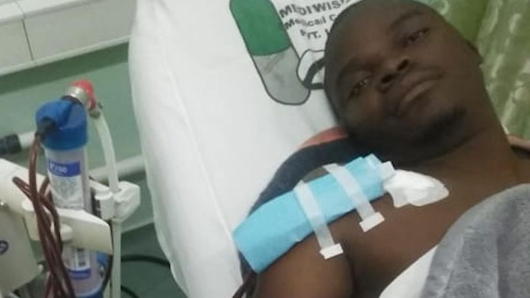M. Muchehiwa a subi des coupures à la poitrine, la peau de sa fesse droite avait été enlevée et ses reins fonctionnaient à peine