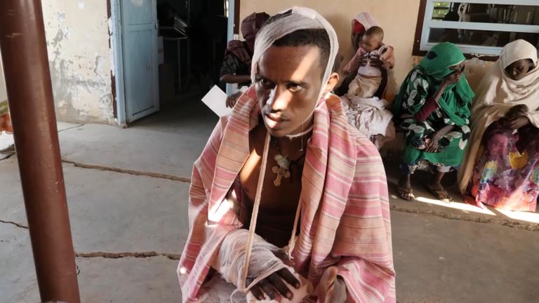 Un homme du Tigray a déclaré que ses voisins avaient tenté de le tuer en révélant son identité à des combattants d'un autre groupe ethnique.
