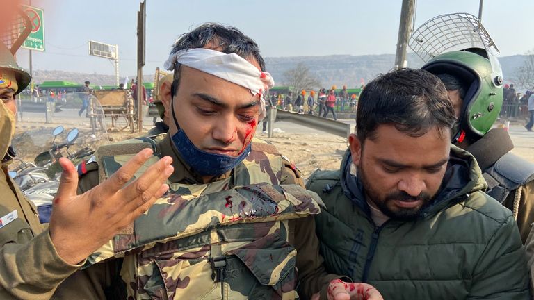 Sky News a vu un policier saigner du front