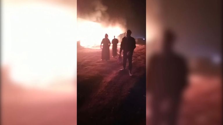 Dalal, 18 mois, a été gravement brûlé dans l'incendie d'une tente en Syrie