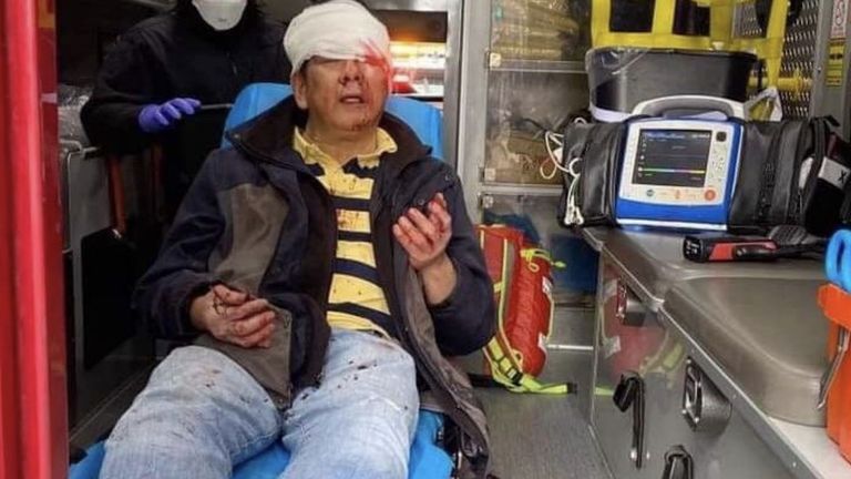 Danny Yu Chang envisage de quitter la Californie après avoir été agressé pour se rendre à son bureau