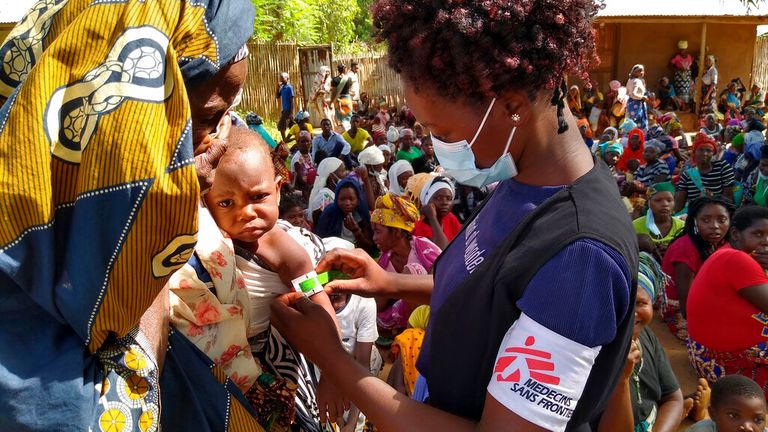 Sur cette photo datée du vendredi 19 février 2021, mise à disposition par Médecins Sans Frontières, montrant un membre du personnel de MSF (Médecins Sans Frontières) mesurant la circonférence du bras d'un enfant pour vérifier la malnutrition à Meluco, dans la province mozambicaine du nord de Cabo Delgado.  La crise humanitaire dans le nord du Mozambique augmente rapidement avec plus de 650000 personnes déplacées par l'insurrection extrémiste islamique dans la province de Cabo Delgado, selon un communiqué du mardi 16 mars 2021, de l'Internatio