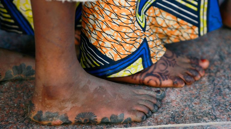 `` La plupart d'entre nous nous sommes blessés aux pieds '', a déclaré une écolière