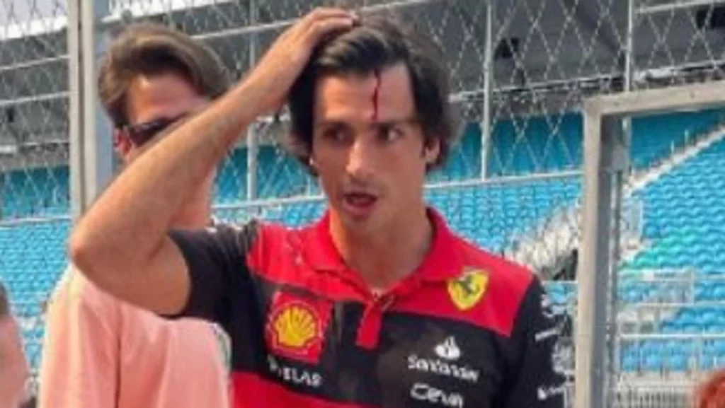 Grand Prix de Miami 2022 : Carlos Sainz, pilote Ferrari, laissé en sang après une gaffe avant la course, actualités F1